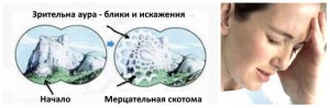 Рак предстательной железы стадии прогноз