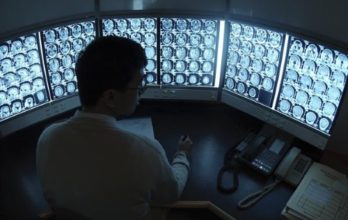 Шансы на будущее у детей при глиобластоме