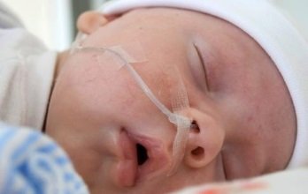 Понятие, причины перинатальной энцефалопатии, актуальные вопросы диагностики и лечения