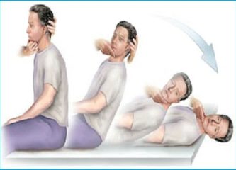 Доброкачественное позиционное пароксизмальное головокружение