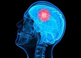 Глиобластома — одна из самых злокачественных опухолей мозга