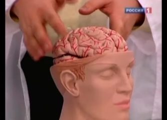 Симптомы инсульта