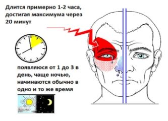 Все о кластерных головных болях